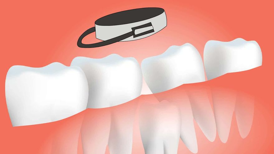 Dental surgery tooth