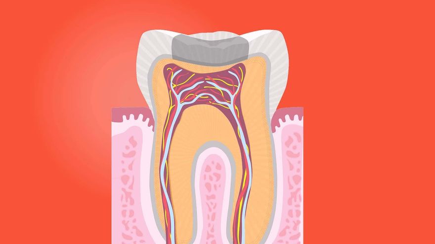 Tooth Root Canal